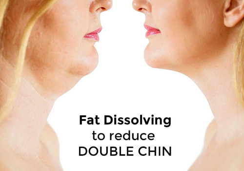 FAQ’S – INJECTION LIPOLYSIS