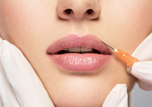 Lip Fillers: How Long They Last, Candidates, Before and Afters, Side Effects, Cost